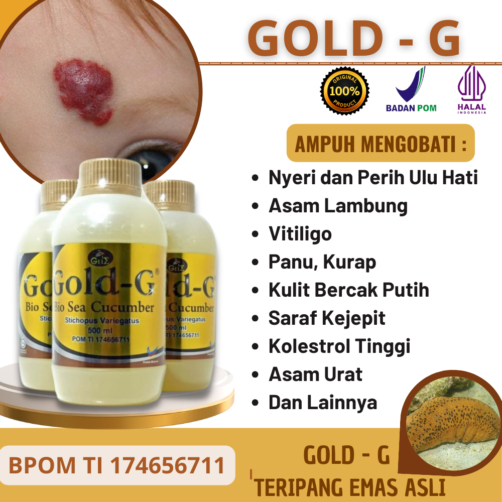 Hemangioma, Tanda Lahir Hitam, Cokelat, Merah, Tompel, Tanda Lahir Merah Menonjol Pada Bayi // Ampuh