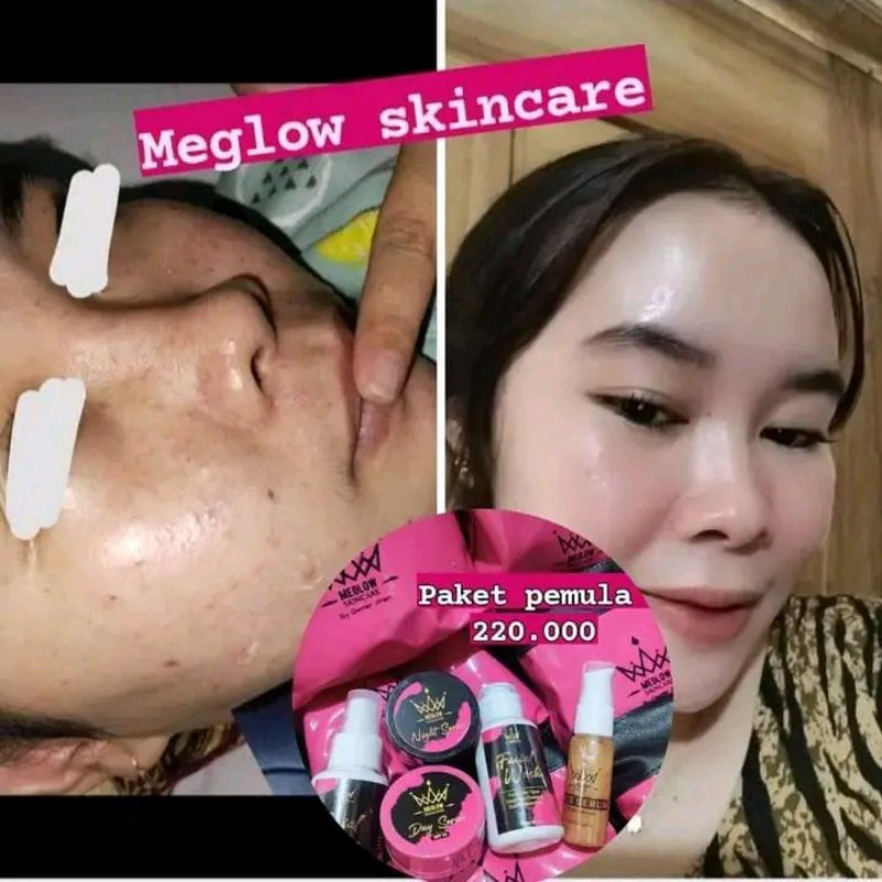 meglow skincare