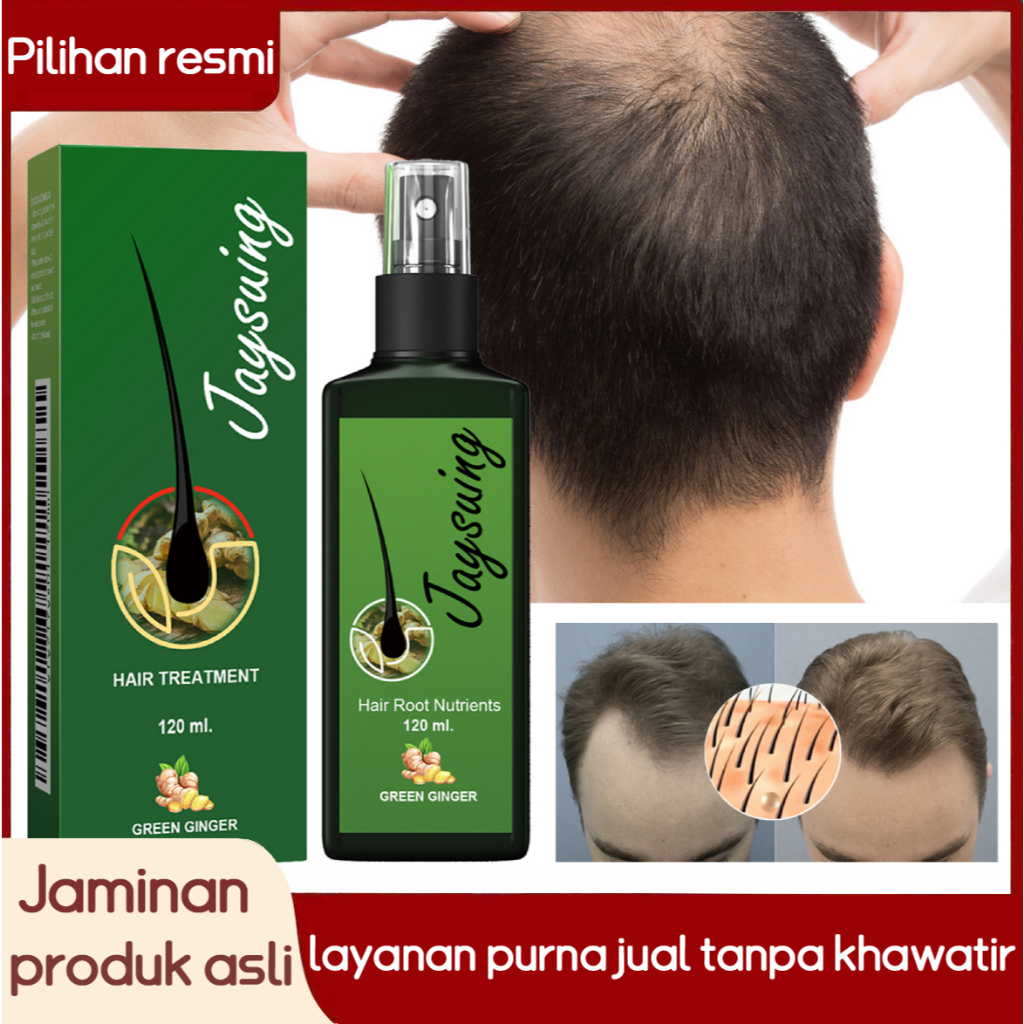 JAYSUING Rambut Serum Penumbuh Rambut Cepat Hair Growth Spray Obat Penumbuh Rambut Penumbuh Rambut B