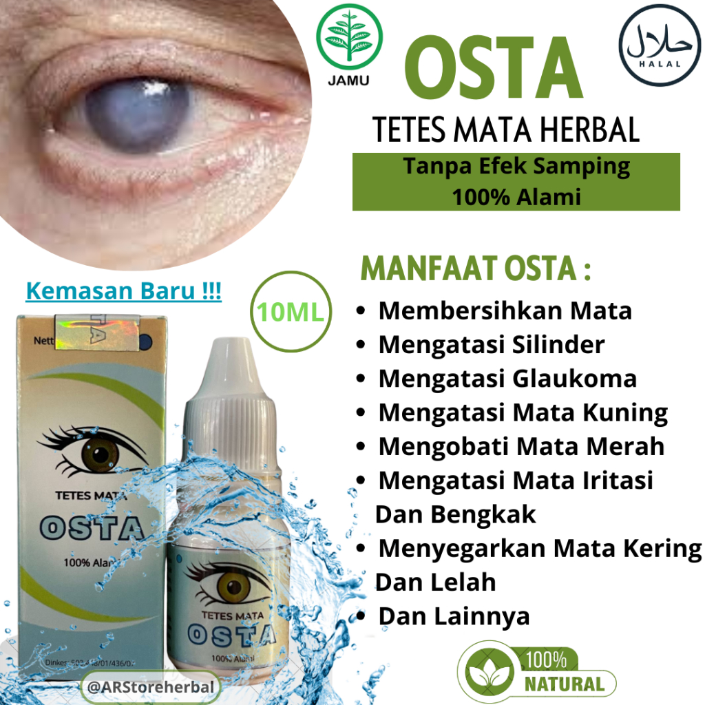 Tetes Mata Herbal OSTA Paling Ampuh Atasi Mata Katarak, Mata Plus, Kelopak Mata Turun