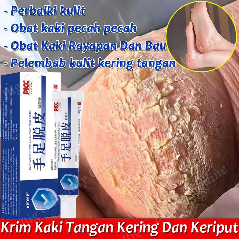 Salep Kaki Pecah2 Paling Ampuh Krim Tangan Kering Dan Keriput Cream Kaki Pecah Dan Kering Pelembab K