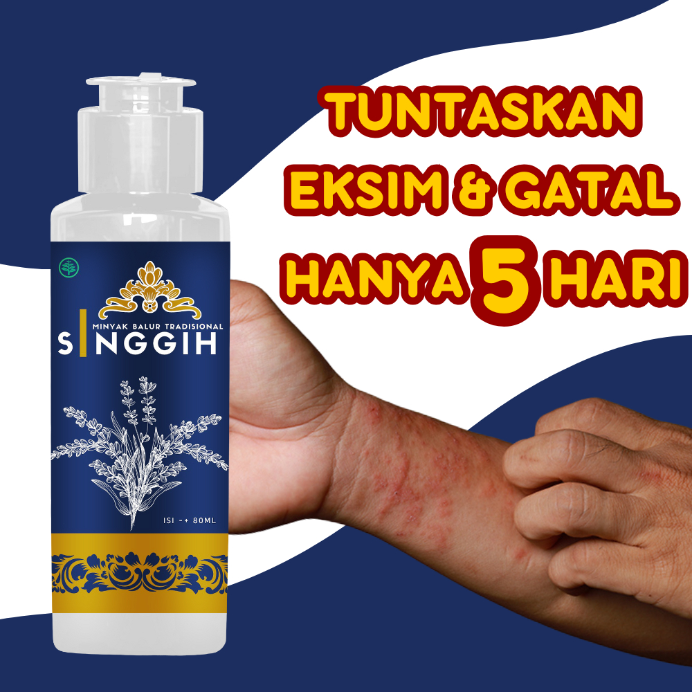 Obat Salep Gatel Gatal Selangkangan Eksim Exsim Kudis Kurap Gudik Luka Psoriasis Herpes Borok Biang 