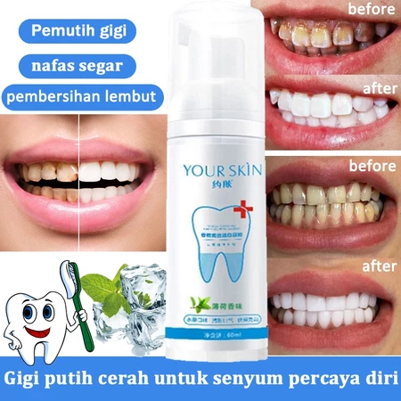 Pembersih Gigi Busa Mousse Pasta Gigi Pemutih Gigi Agen Depigmentasi