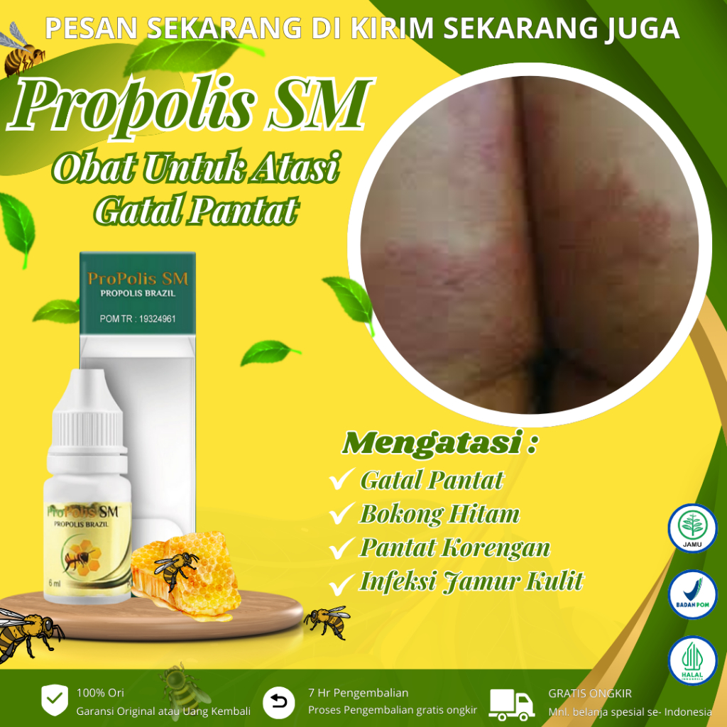 Propolis Sm - Obat Gatal Pantat, Jerawat Bokong, Pemutih Pantat Hitam, Gatal Di Selangkangan - Masal