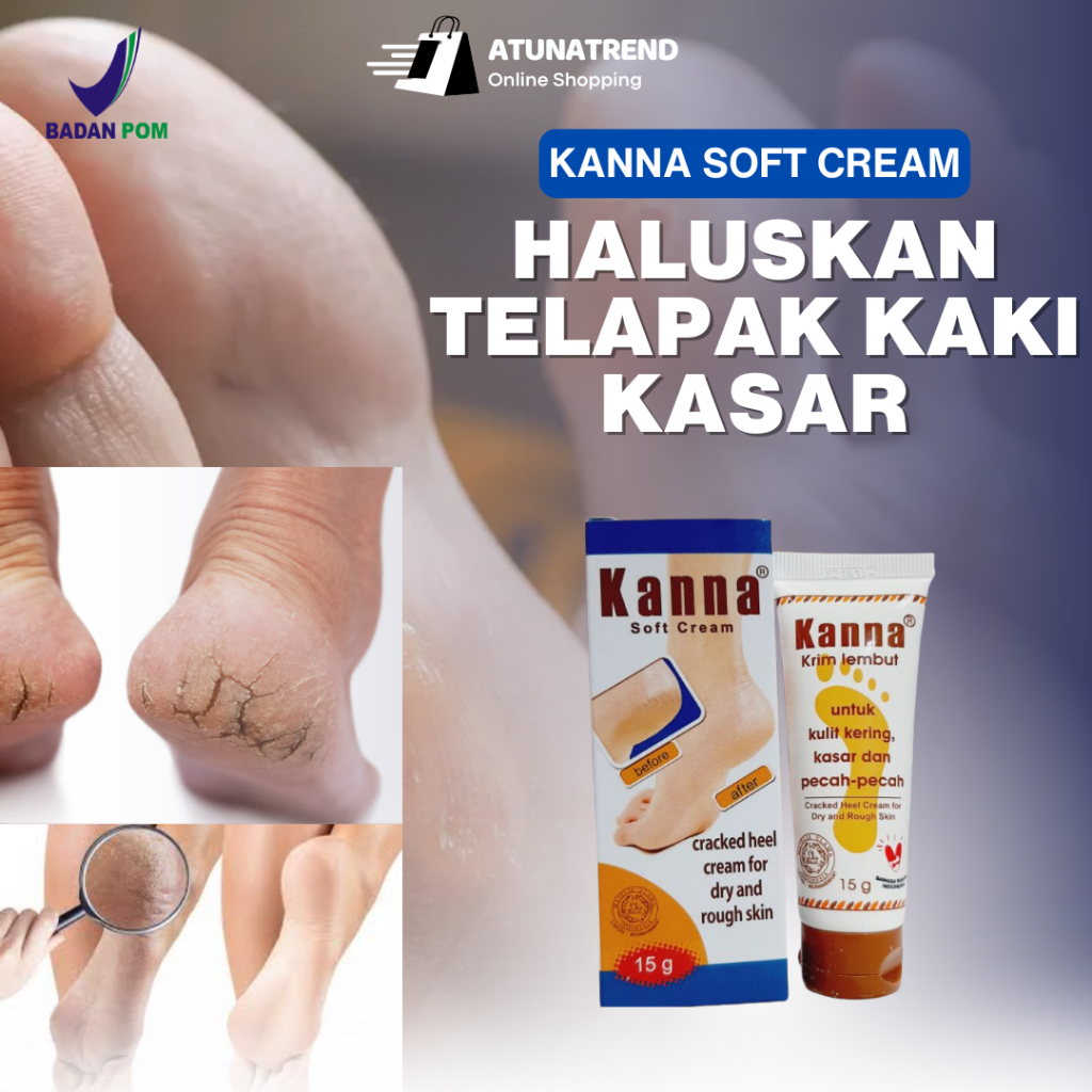 anna Cream Kaki Pecah Pecah dan Kering Original Krim Tumit Kaki Ampuh Buat Kaki Pecah2 Kering