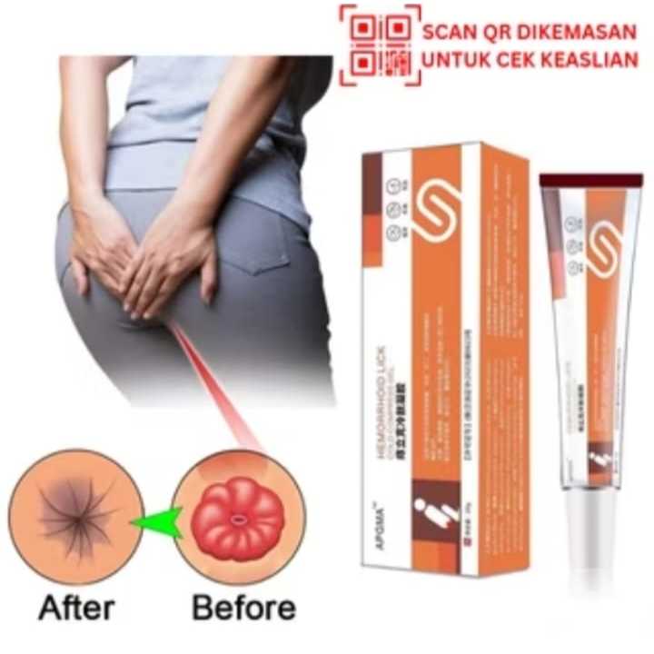 APDMP Salep Ambeyen Obat  Wasir/Krim Ambeien/Obat ambeien/Salep Ambeien /Paling Ampuh wasir Ambeien 