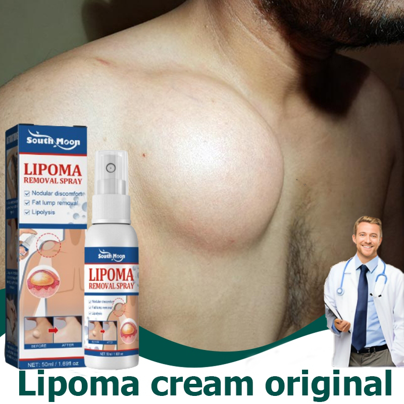 Lipoma cream original obat benjolan lipoma cream obat lipoma salep lipoma salep benjolan lipoma remo