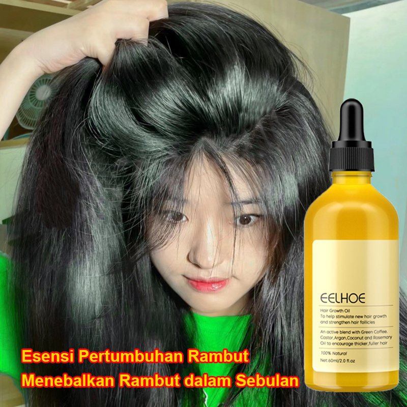 rosmery oil untuk rambut penumbuh rambut serum penumbuh rambut hair serum rambut rontok Hair Growth 