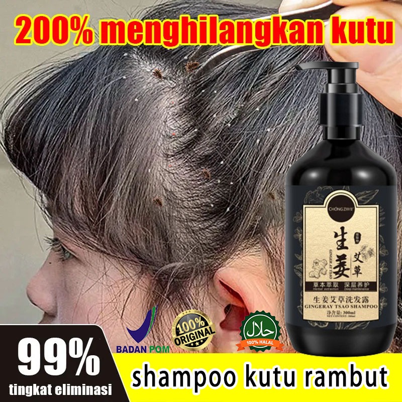 Shampo Kutu Rambut Anak 300ml Anti Ketombe dan Gatal