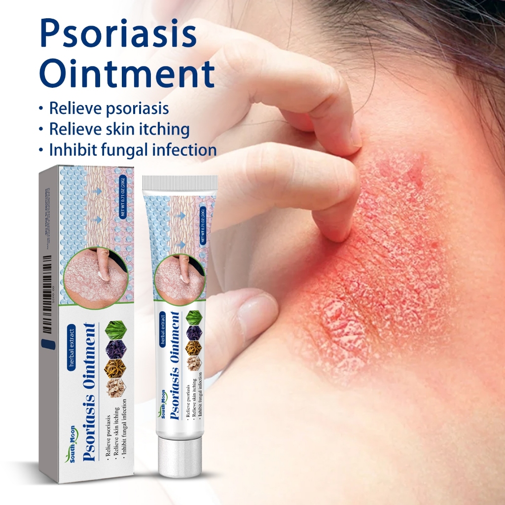 100% ORI Salep Gatal Paling Ampuh Obat Psoriasis / Salep Gatal Paling Ampuh untuk Penyakit Kulit