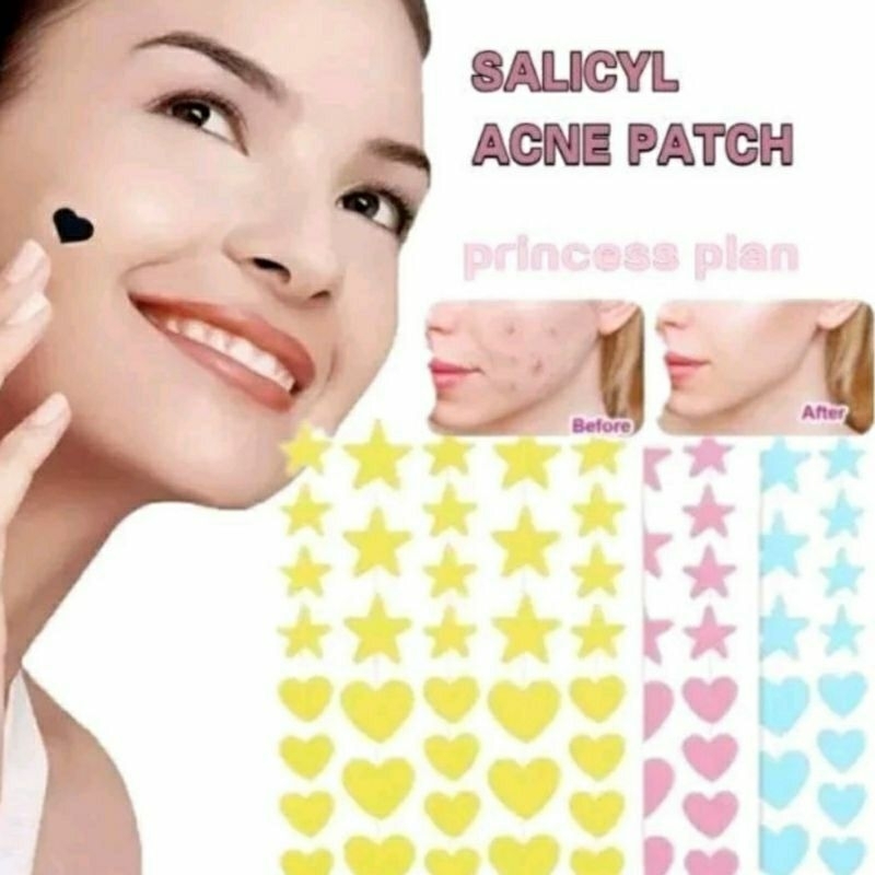 Acne Patch jerawat /tempelan jerawat / acne patch lucu motif bintang love