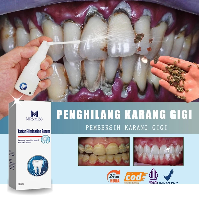 odol pemutih gigi dan karang gigi alat pembersih karang gigi pemutih gigi ampuh 100% original peront