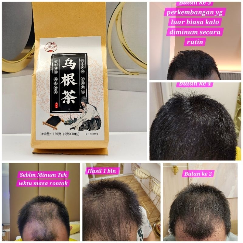 

[Ready] Produk Asli Cheng Woh Penang Hair Revive Tea / Teh Mencegah Kerontokan / Teh Penumbuh Rambut / Memperkuat Akar Rambut