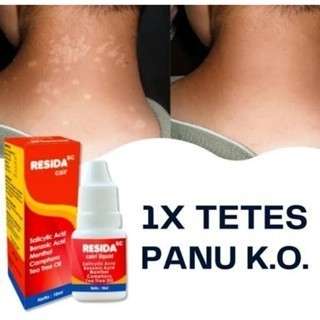 Resida Cair Sperti Kalpanax Cair Original 10 Ml Untuk Panu Dan Kurap