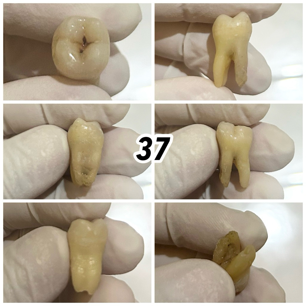 JUAL GIGI ASLI PRAKTIKUM / GIGI MANUSIA / KEDOKTERAN GIGI