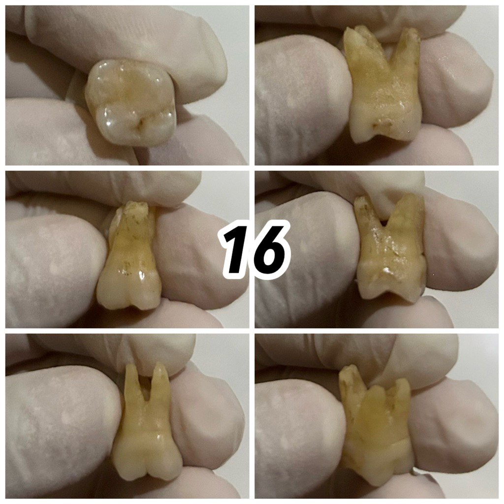 JUAL GIGI ASLI PRAKTIKUM / GIGI MANUSIA / KEDOKTERAN GIGI