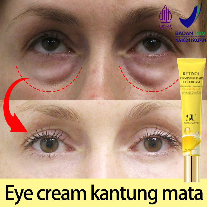 【BPOM】Krim mata Serum mata Serum mata panda dan kantung mata 20g Eye cream kantung mata Penghilang m