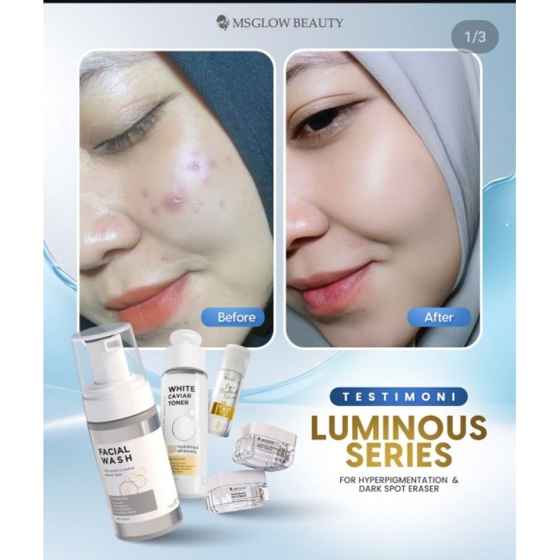 Paket MS Glow Luminous - luminous ms glow series - ms glow original - paket luminous ms glow