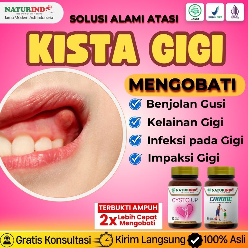 Obat Kista Gigi Tumor Gigi Benjolan Gusi Kelainan Gigi Herbal Ampuh