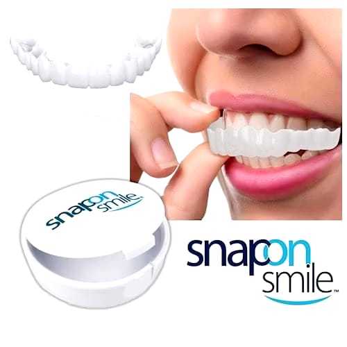 KUALITAS TERBAIK  Snap On Smile 100% ORIGINAL Authentic / Gigi Palsu Snap on Smile 1 SET