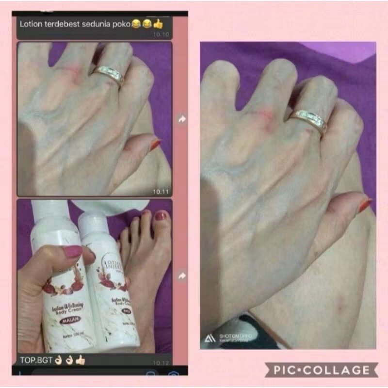 Lotion Injeksi 3000gs Original