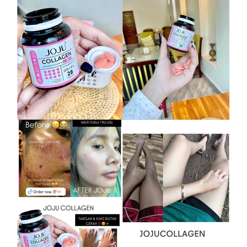 JOJU COLLAGEN ORIGINAL 100% for WHITENING & ACNE