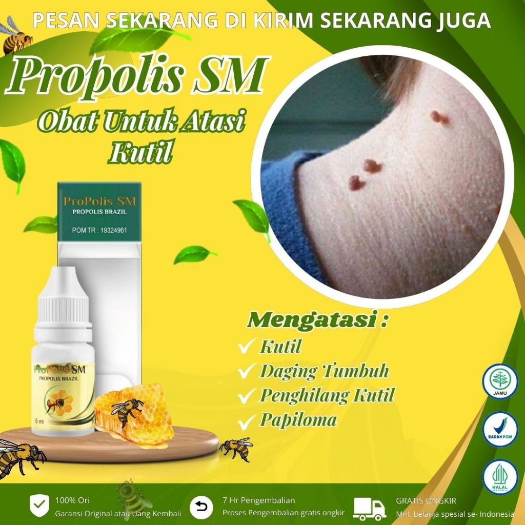 Propolis SM - Obat Kutil Tangan, Obat Oles Kutil, Obat Penghilang Kutil, Obat Kutil di Kelopak Mata,