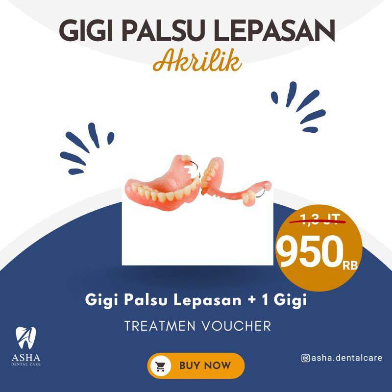 Gigi Palsu Lepasan Akrilik