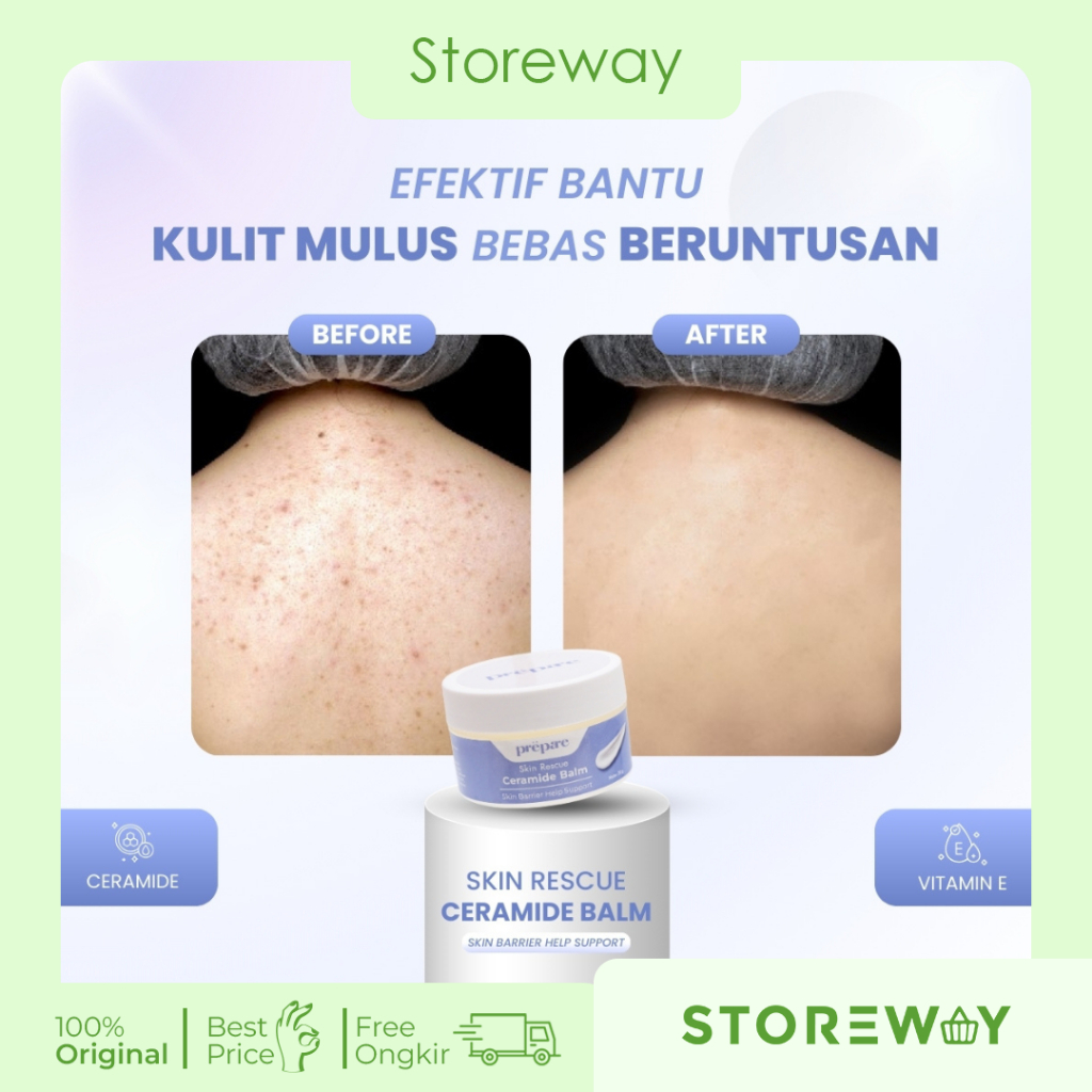 Prepare Pelembab Kulit Kering Salep Eksim Kering Paling Ampuh Obat Gatal Kudis Eczema Balm