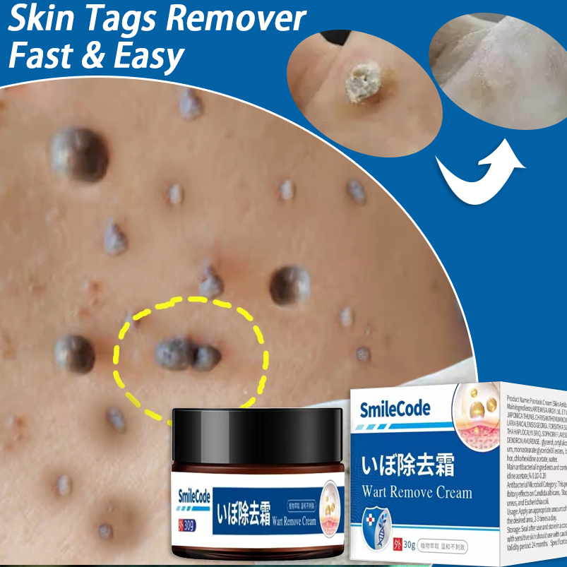 penghilang tahi lalat di wajah obat penghilang tahi lalat penghilang kutil dan tahi lalat wart remov