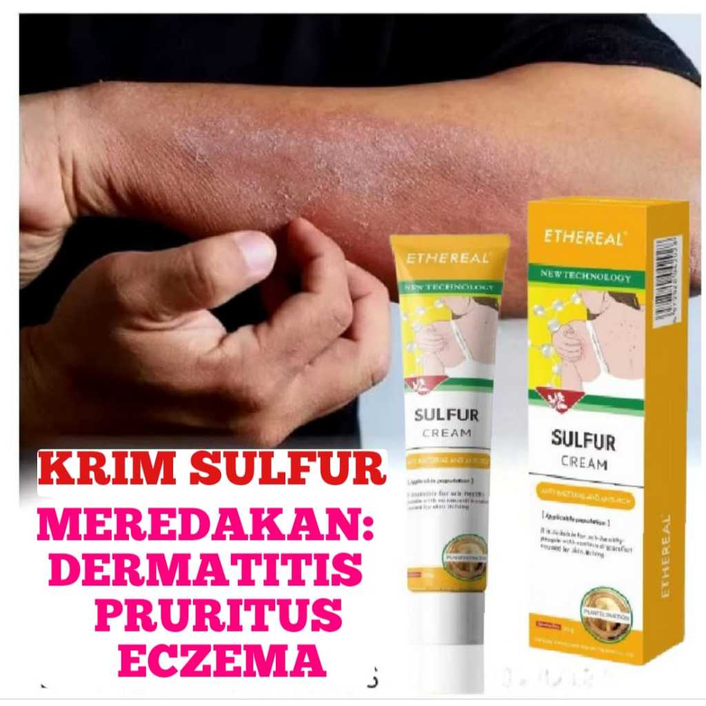 Krim Sulfur Belerang Murni Salep Untuk Gatal Kulit Tubuh Jamur Kadas Kudis dan Kutu Air Paling Ampuh