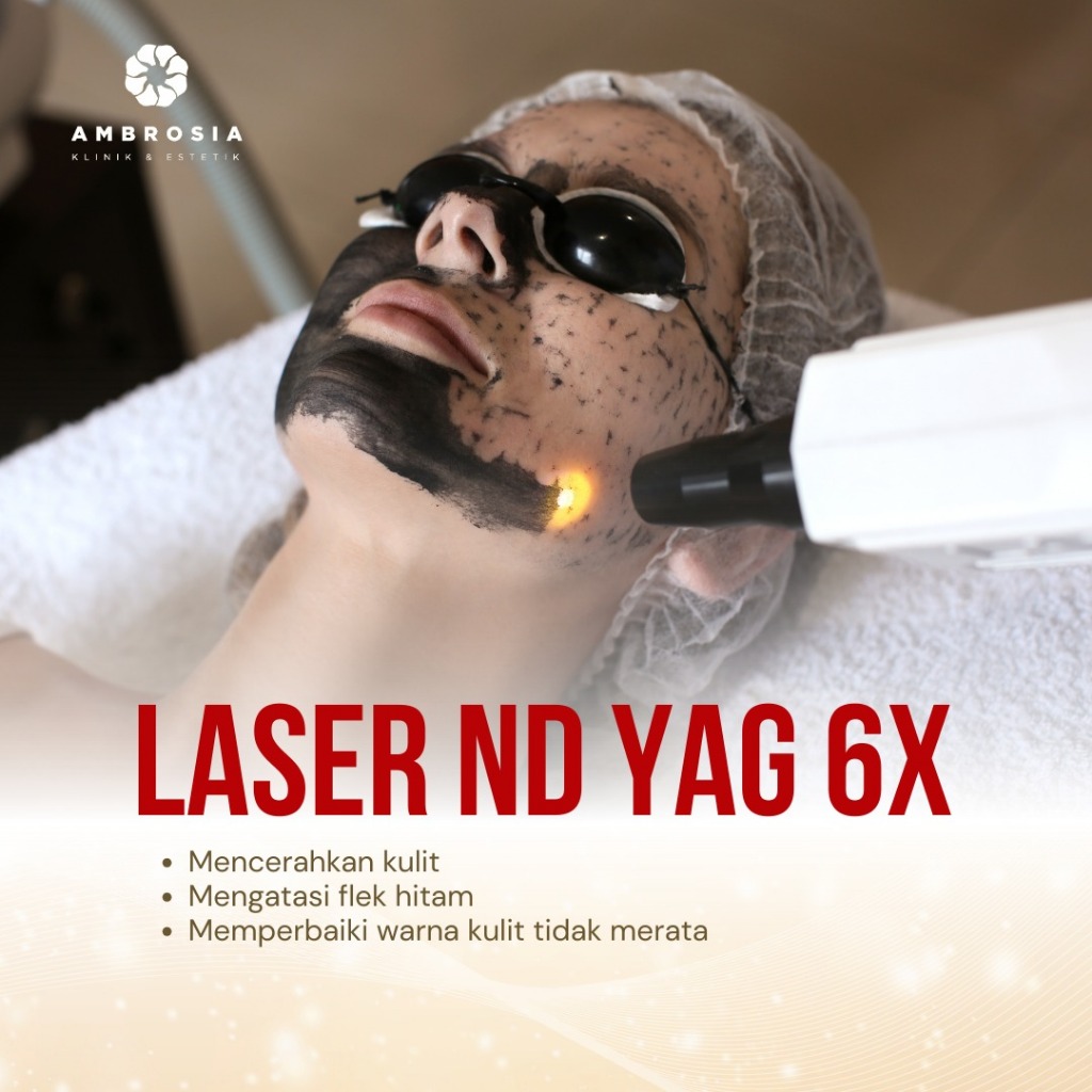 AMBROSIA LASER ND YAG  6X