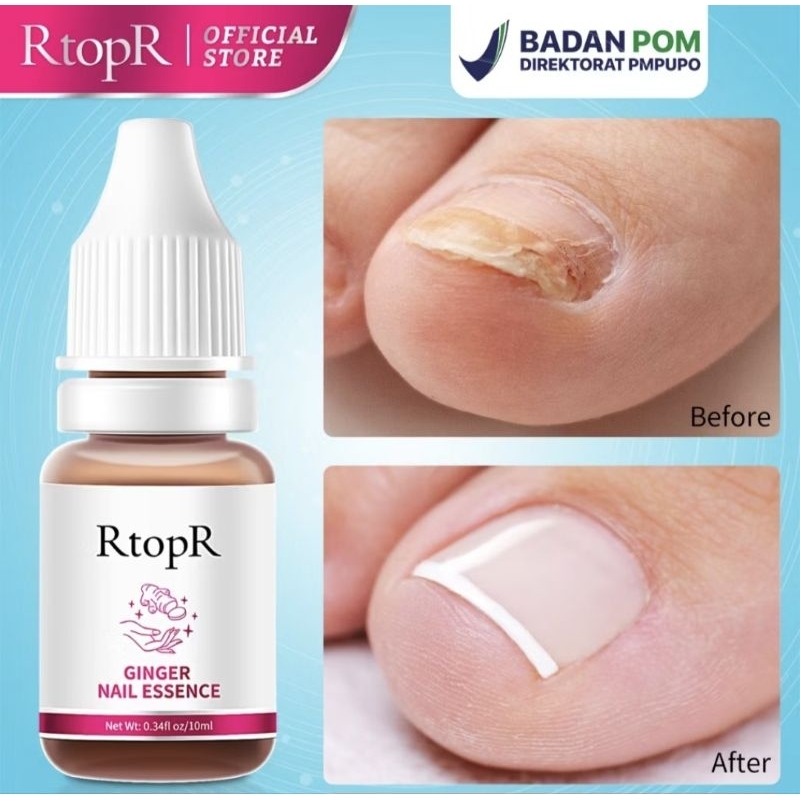 [READY]  RTOPR SERUM KUKU GINGER VIRAL