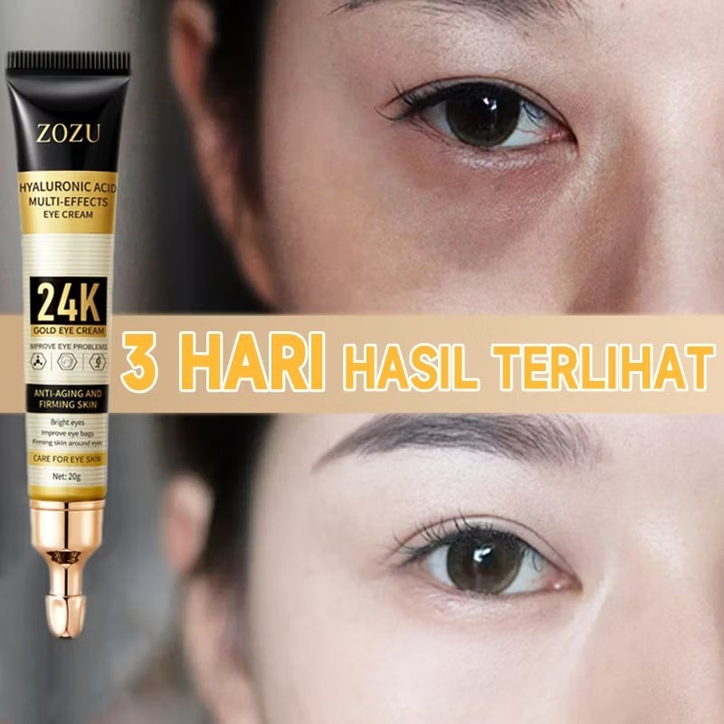 Cream mata panda Menghilangkan mata panda penghilang mata panda Kecantikan