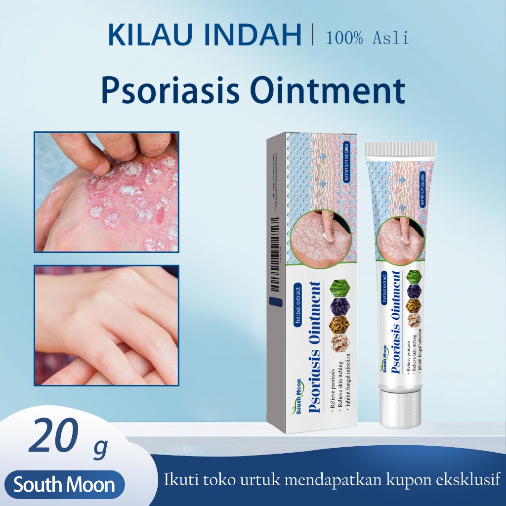 【Ready Stock】South Moon Krim Psoriasis 20g/Krim Anti Gatal/Krim Psoriasis Asli/Krim Psoriasis Khusus