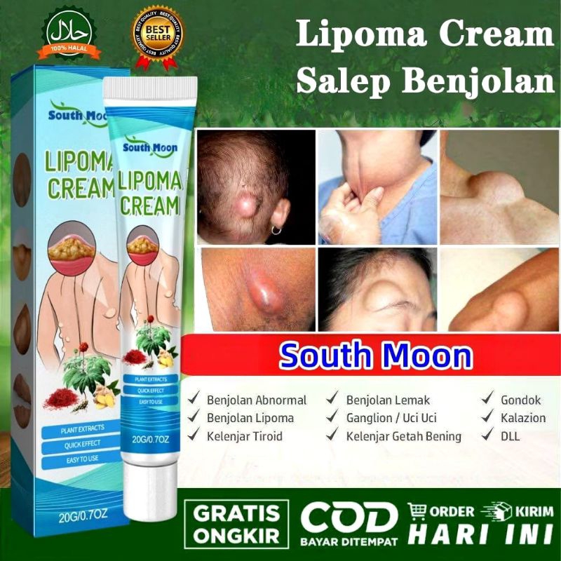 LIPOMA CREAM, LIPOMA OINTMENT