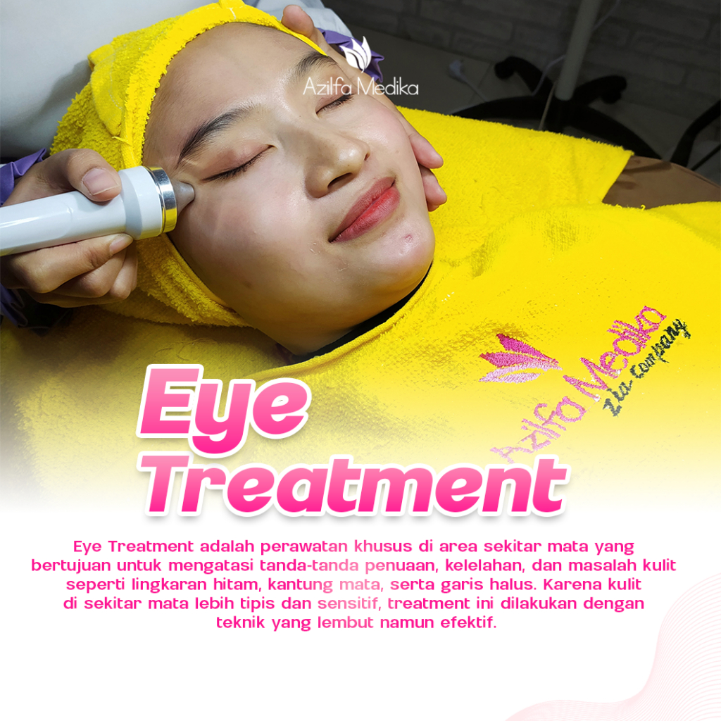 Eye Treatment  Voucher Treatment Azilfa Medika