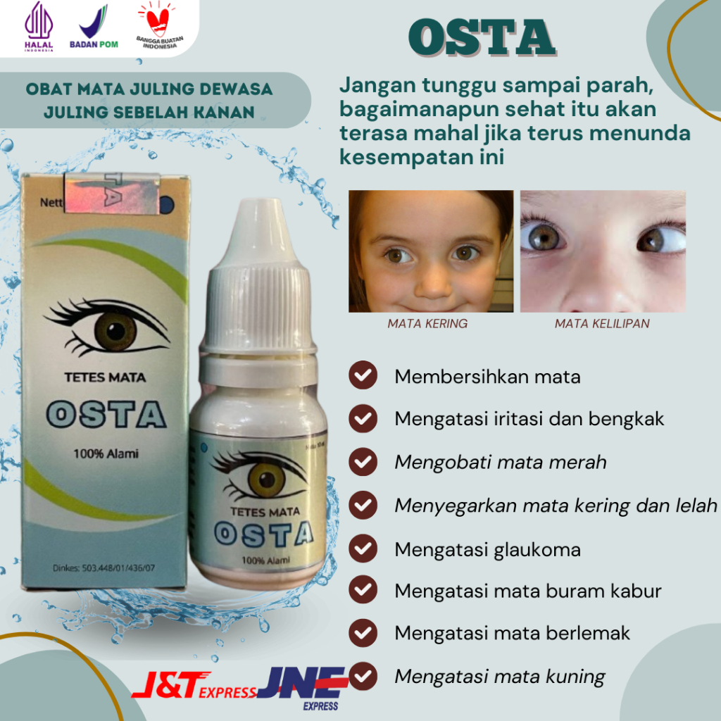 Obat Mata Juling Dewasa Juling Sebelah Kanan atau Kiri Mata Deleng Tileng Mata Tidak Sejajar Rabun J