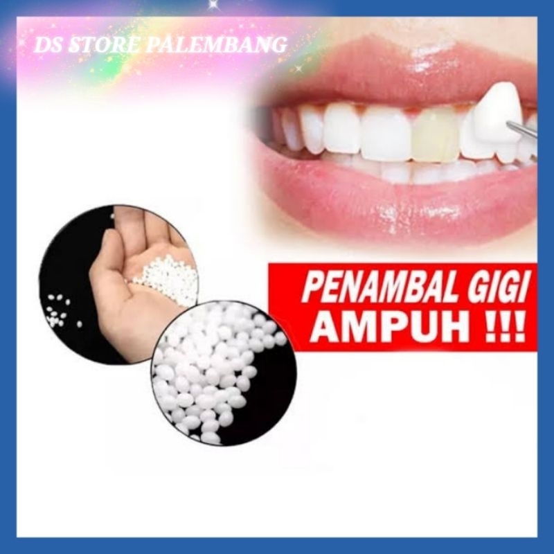 Penambal Gigi Ompong Dan Berlubang