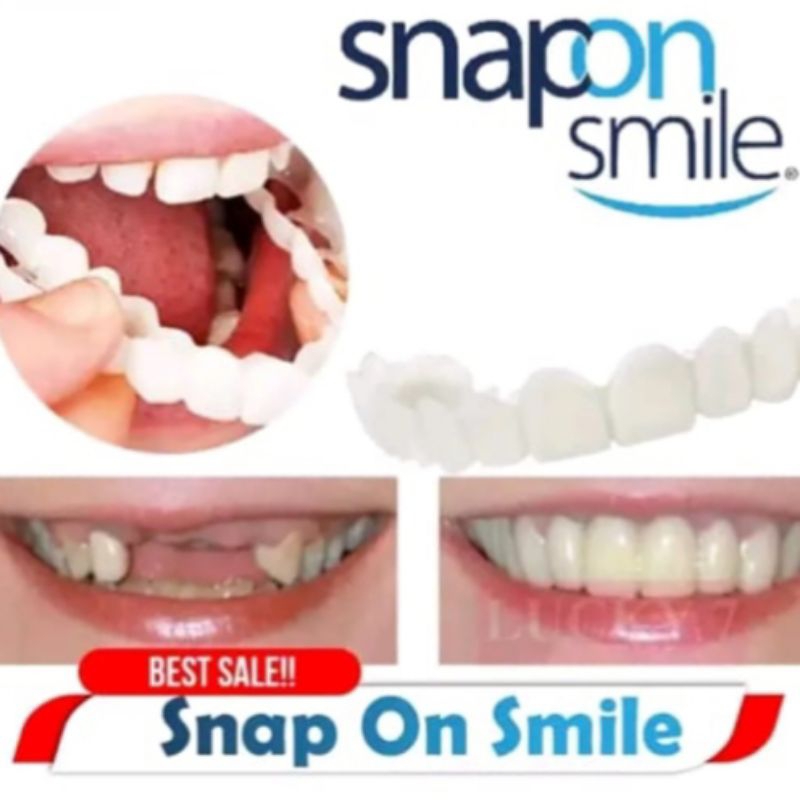 Gigi palsu lepas pasang" gigi palsu atas bawah" gigi palsu asli dokter' pelapis gigi atas bawah tran