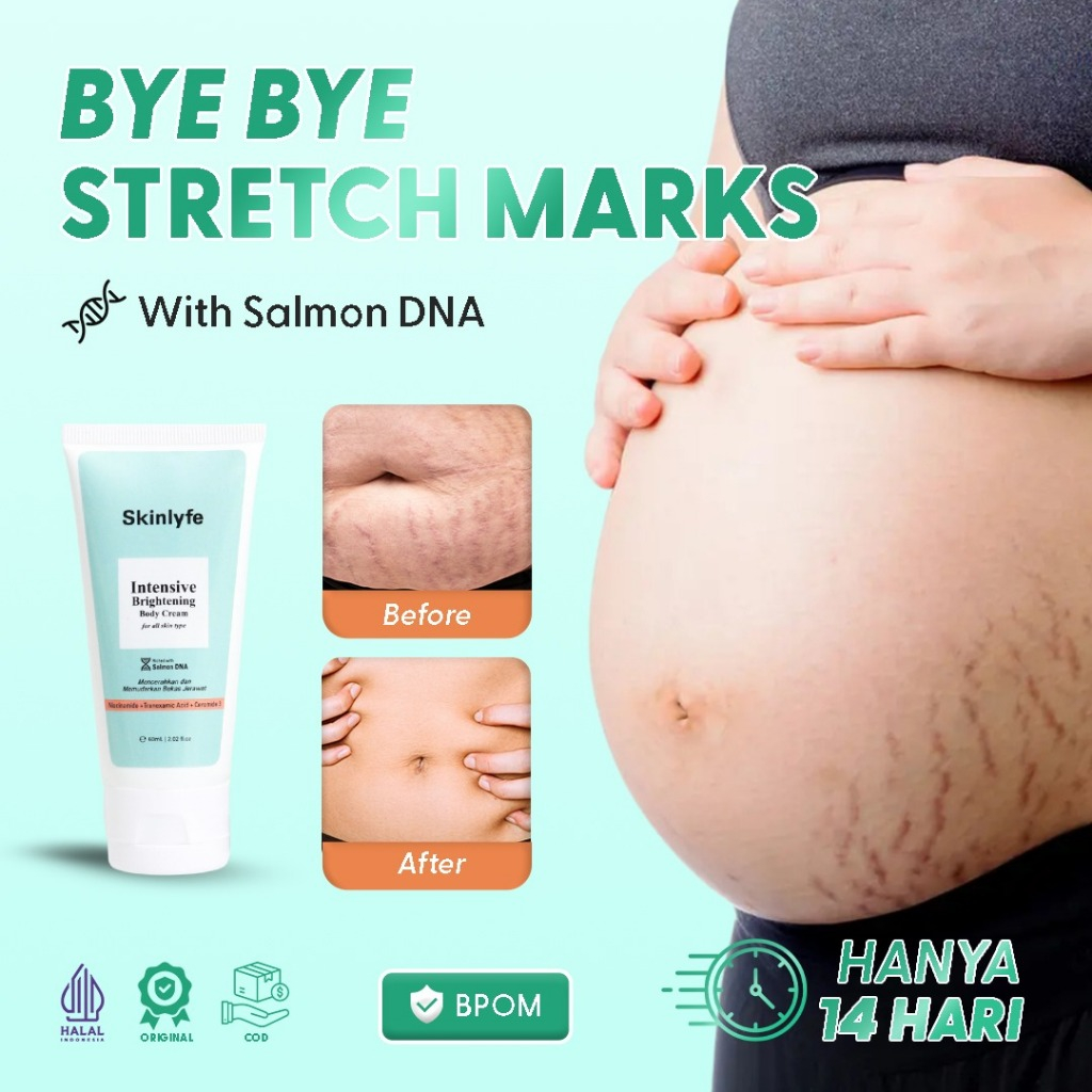 Skinlyfe Penghilang Bekas Luka Menahun Cream Bekas Koreng Cacar Penghilang Strechmark Bopeng BPOM
