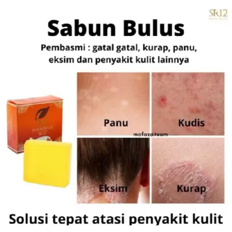 SABUN BULUS SR12 HERBAL BPOM ORIGINAL MENGHILANGKAN GATAL KULIT AMAN BUMIL BUSUI KURAP KUDIS -BULUS 