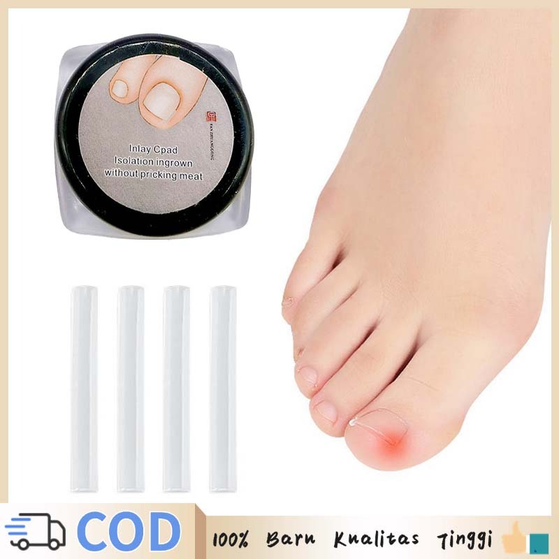 30pcs Bantalan Kuku Cantengan Bantalan Silikon Kuku Bantalan Nails Art Silikon Kuku Cantengan