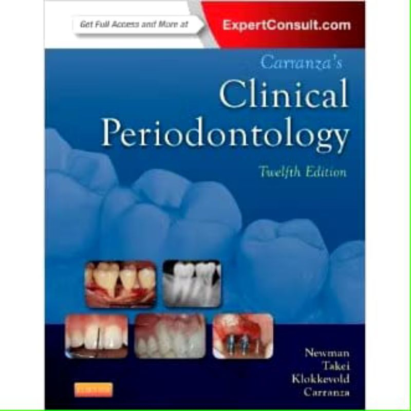 Carranza's Clinical Periodontology