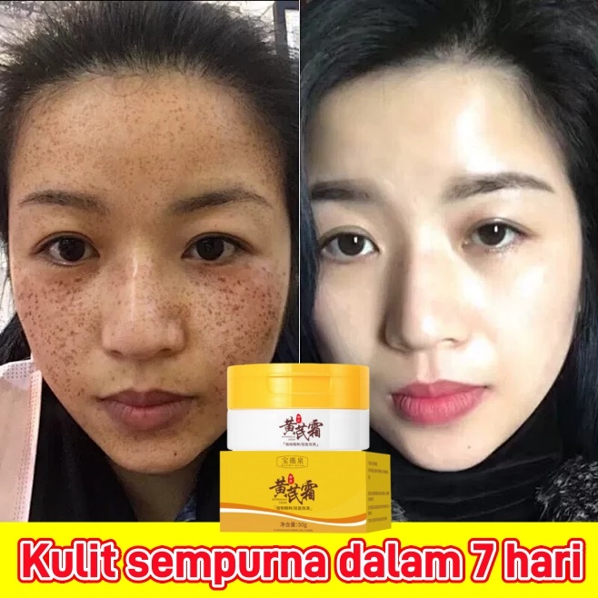Cream Penghilang Flek Hitam 50g Cream Flek Hitam Membandel Menghilangkan Flek Hitam di Wajah krim Pe