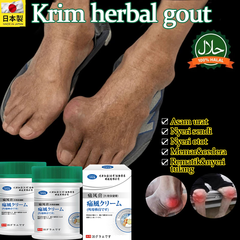Barang asli obat asam urat - Salep asam urat 35g Radang kandung urat Sendi bengkak dan nyeri Salep a