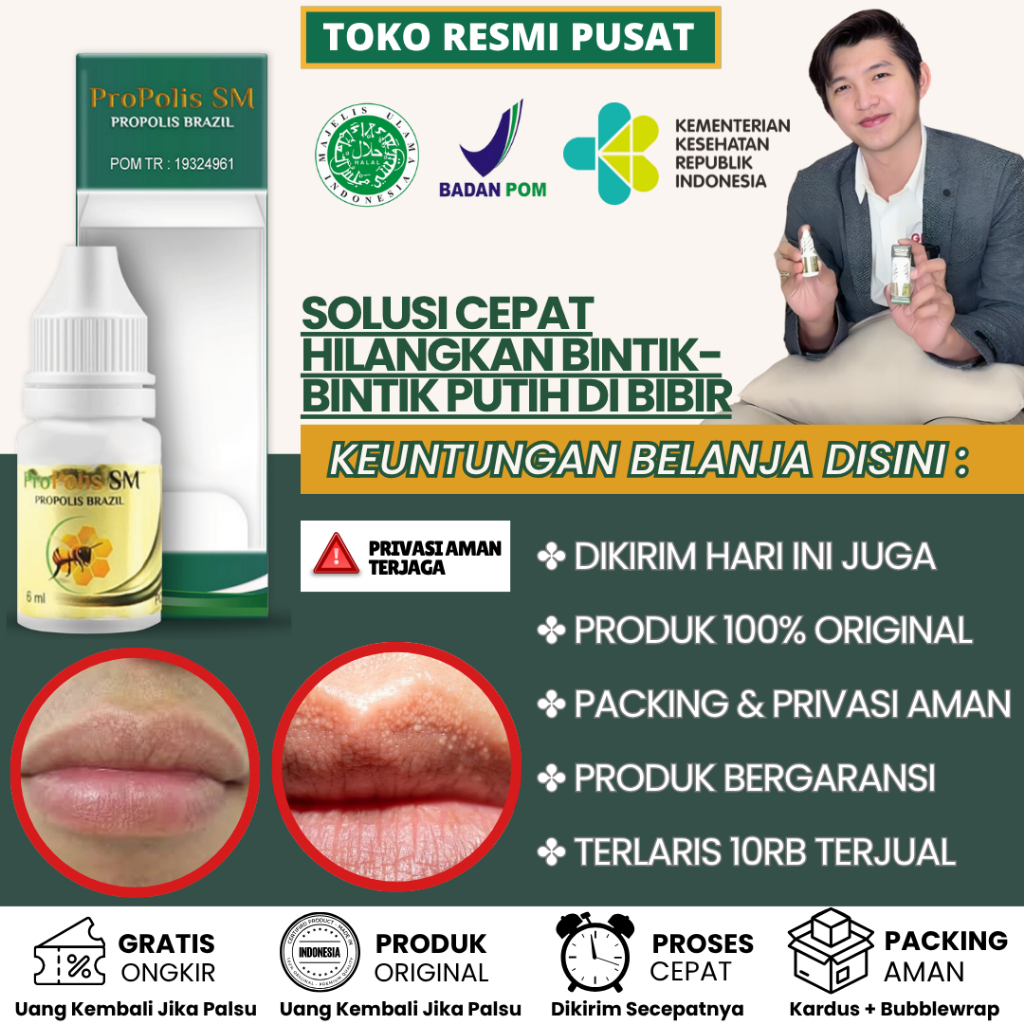 Obat Penghilang Bintik Bintik Putih di Bibir, Bintik Bintik Gatal di Bibir, Fordyce Spots Propolis T