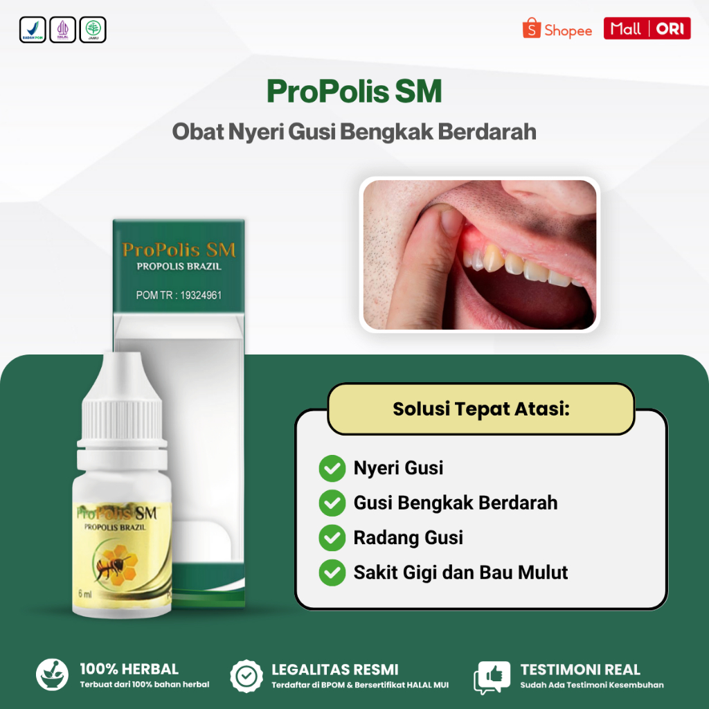 Obat Gusi Bengkak, Nyeri Gusi, Gusi Berdarah, Radang Gusi, Sakit Gigi Berlubang - Propolis SM