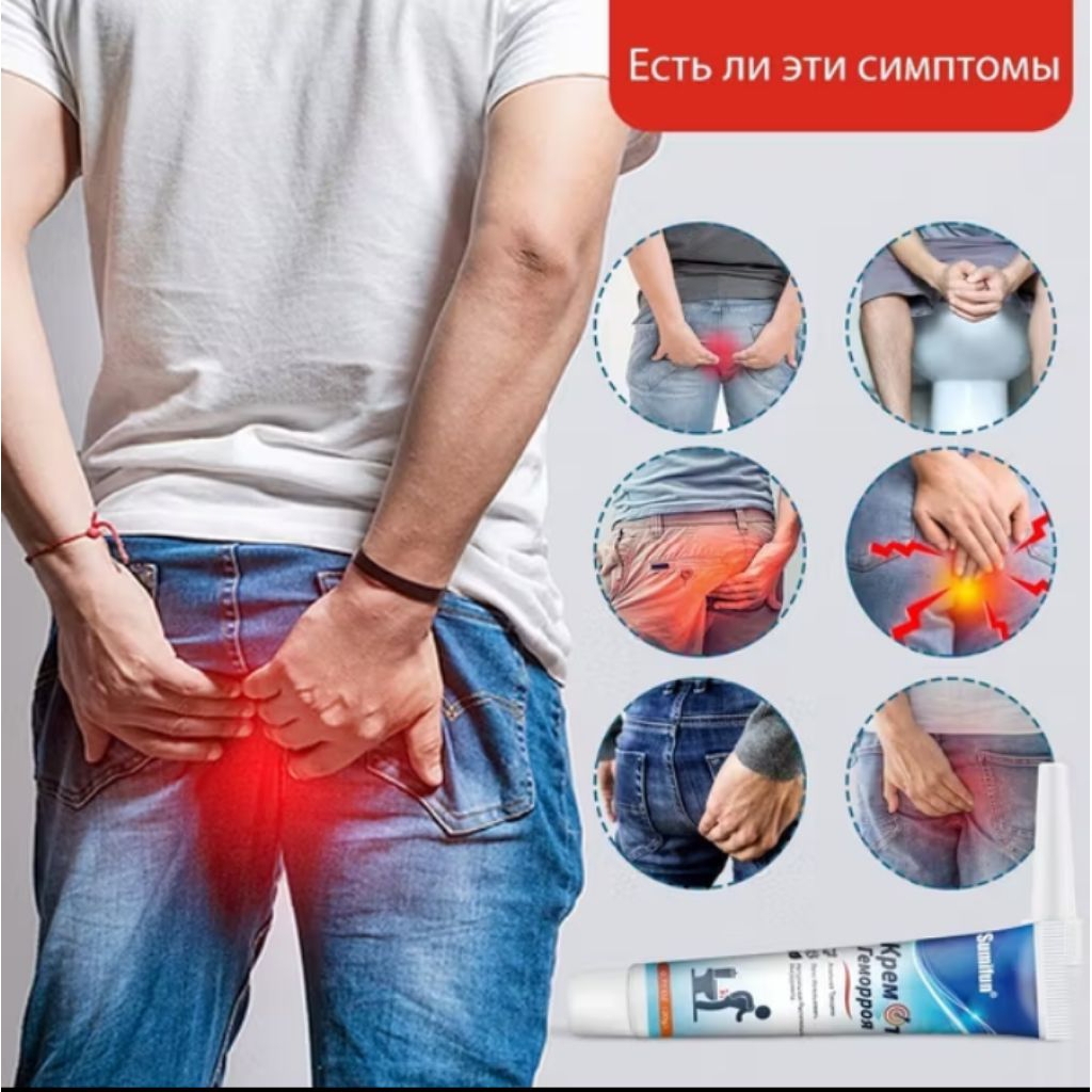 

Obat Wasir atau Embeyen Herbal Tiongkok
