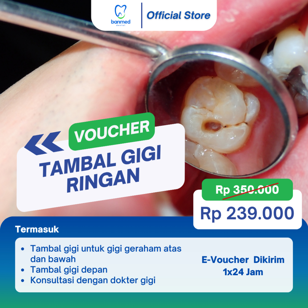 Voucher Tambal Gigi Ringan Berlubang / Lubang Kecil Gigi Depan / Geraham Atas Bawah / Dokter Dental